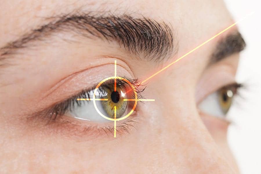 operation laser lasik duree effets long terme ophtalmo specialiste chirurgie refractive paris docteur camille rambaud