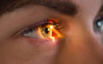 Lasik : avantages & inconvénients