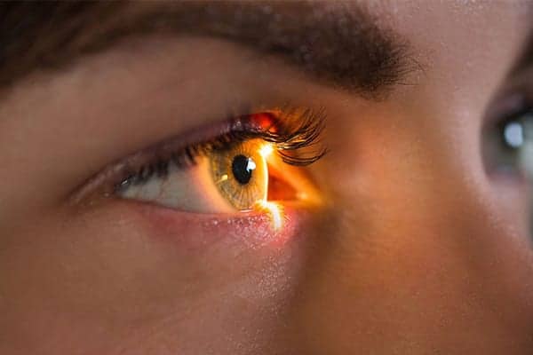 lasik inconvenients avantages ophtalmologue specialiste chirurgie refractive cataracte paris dr camille rambaud