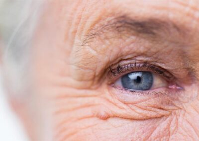 Peut-on opérer un seul œil de la cataracte ?