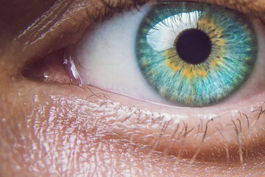la myopie peut elle disparaitre ophtalmologue specialiste chirurgie refractive cataracte paris dr camille rambaud