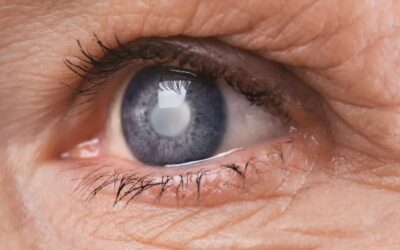 Comment réduire l’angoisse liée à la chirurgie de la cataracte ?