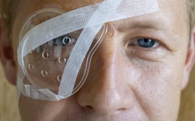 Opération au laser pour les yeux : quel est le temps de récupération ?