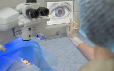 SMILE : principes de cette chirurgie réfractive