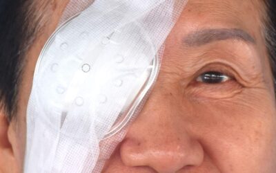 Cataracte après une vitrectomie : que faire ?