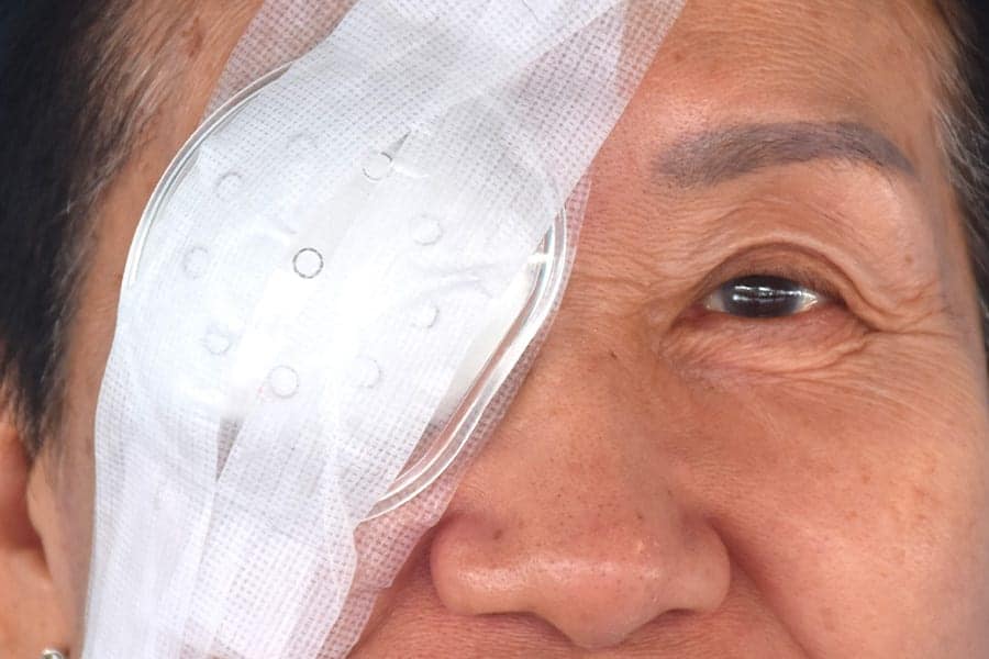 cataracte apres vitrectomie dr camille rambaud ophtalmologiste specialiste chirurgie refractive cataracte paris