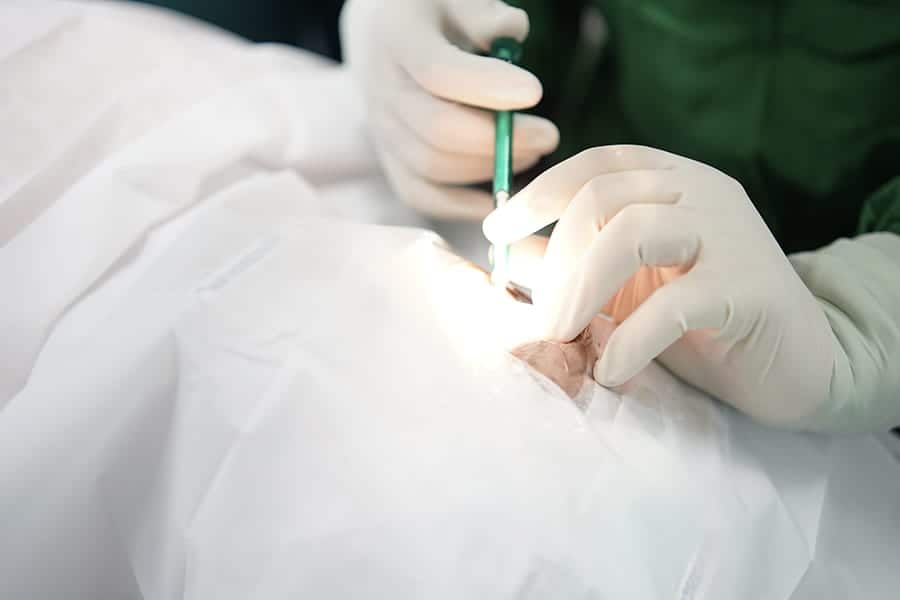 implant chirurgie cataracte prix inconvenients duree recuperation operation cataracte chirurgien ophtalmologue specialiste chirurgie cataracte paris dr camille rambaud