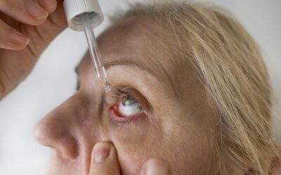 Sécheresse oculaire après une opération de la cataracte : comment réduire l&rsquo;inconfort ?